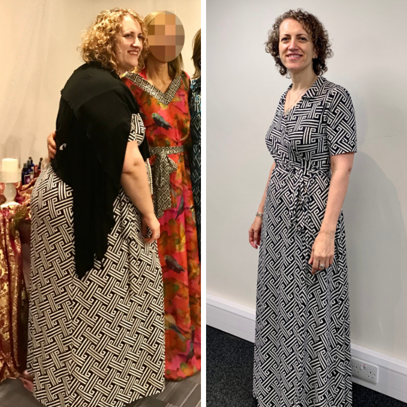 Client before and after weight loss in a patterned dress