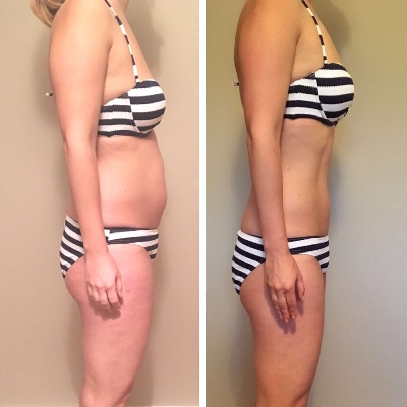 Client before and after side-profile weight loss